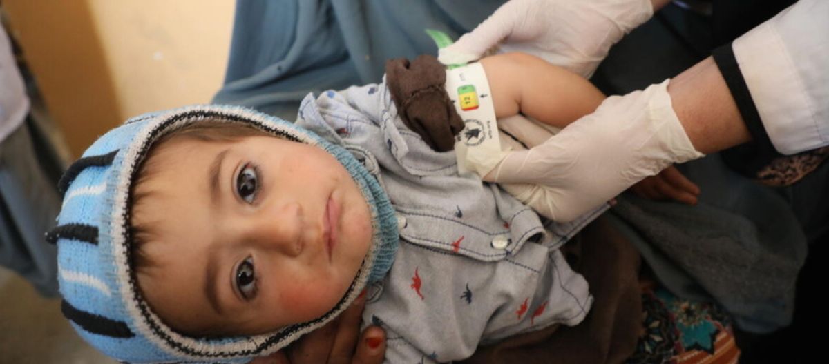 In this photo, Aziz 1.5 years old who is suffering malnutrition, is recieving care at a WFP-supported clinic.