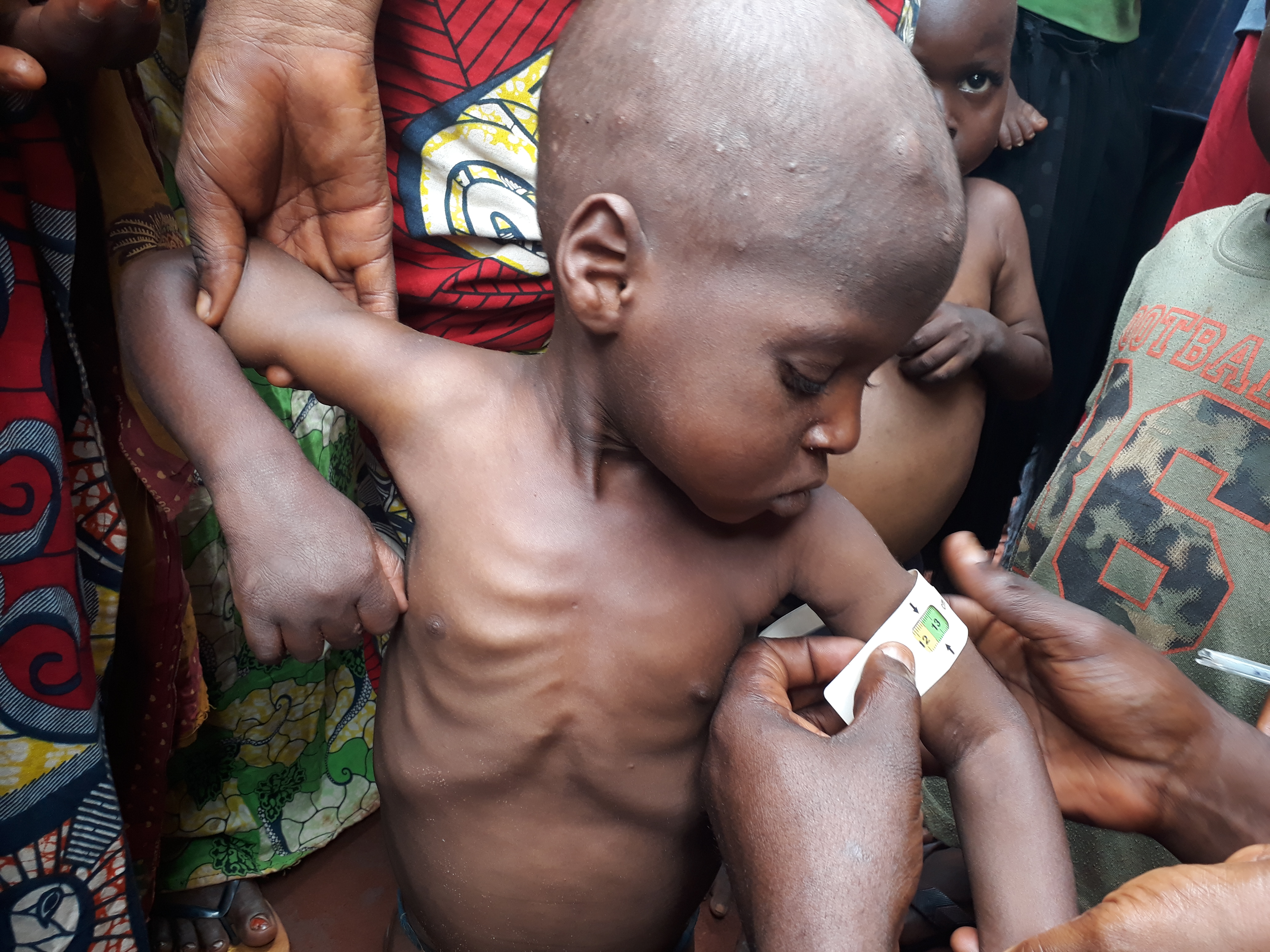 Kasai, DRC: millions at risk as funding dries up