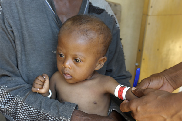 Madagascar’s Prime Minister Calls For Support And Investment Against Chronic Malnutrition