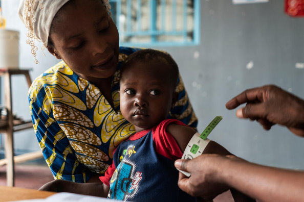 WFP/Arete/Fredrik Lerneryd. WFP staff, Francis Mpoyi, measures baby's arm during a routine check-up in Kalemie, Democratic Republic of Congo on 19th February 2021.