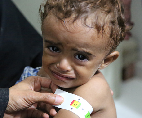 WFP Launches New Emergency Operation In Yemen To Feed Millions On Brink Of Famine