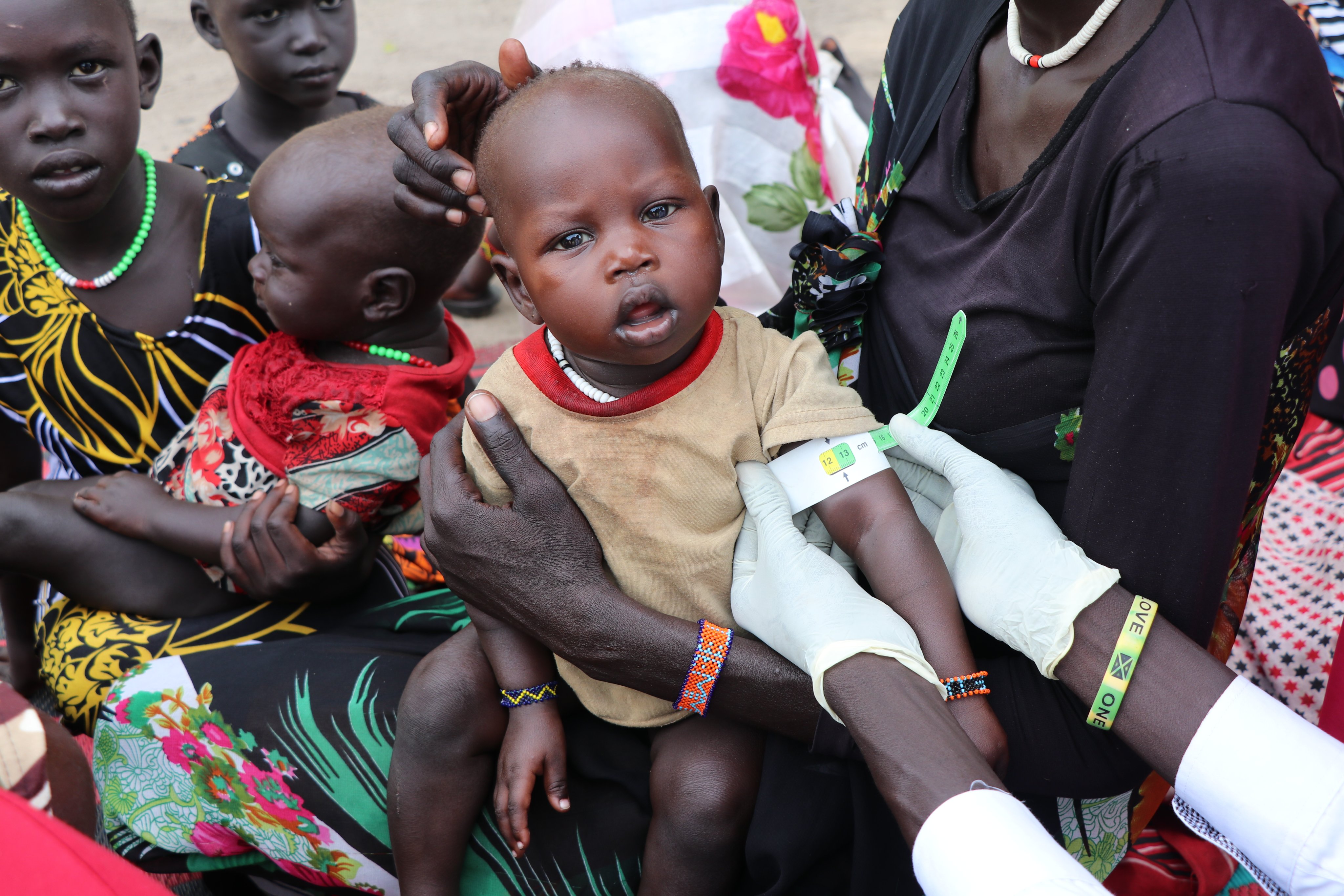 south sudan nutrition