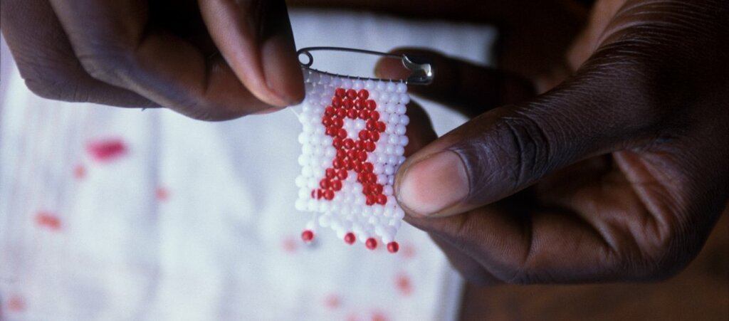 HIV/AIDS and tuberculosis