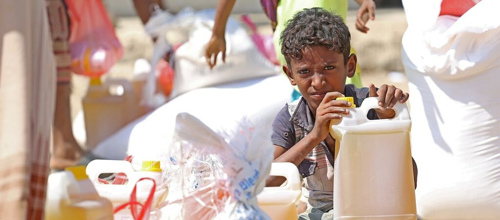 Boy with food items distributed by WFP due to the high levels of food insecurity and malnutrition in Yemen 