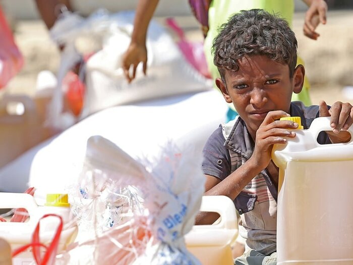 Boy with food items distributed by WFP due to the high levels of food insecurity and malnutrition in Yemen 