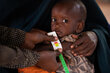 In this photo Mashallah (2) is held by his mother Dahera (28) while his MUAC is measured and he is assessed for malnutrition.