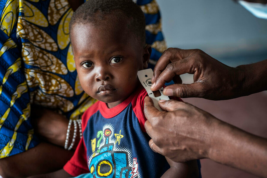 Boy receives a nutrition assessment in DRD