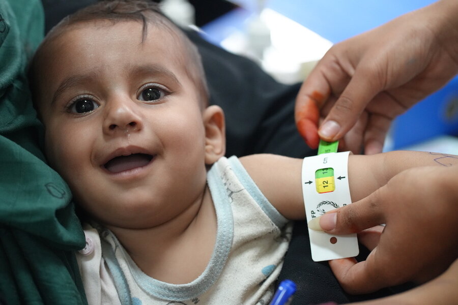 Child having arm circumference measured