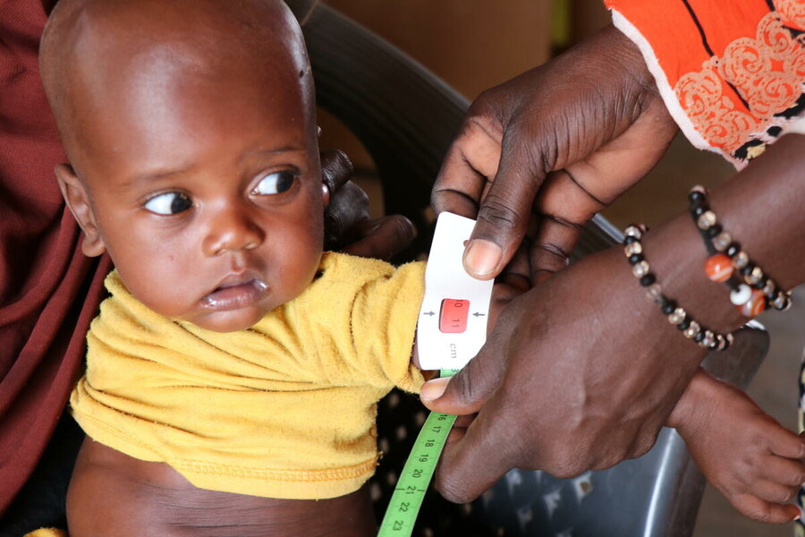 A child is checked for malnutrition at the WFP-supported Tchiworou Health Center. The red measurement indicates severe malnutrition. Photo: WFP/Amadou Baraze