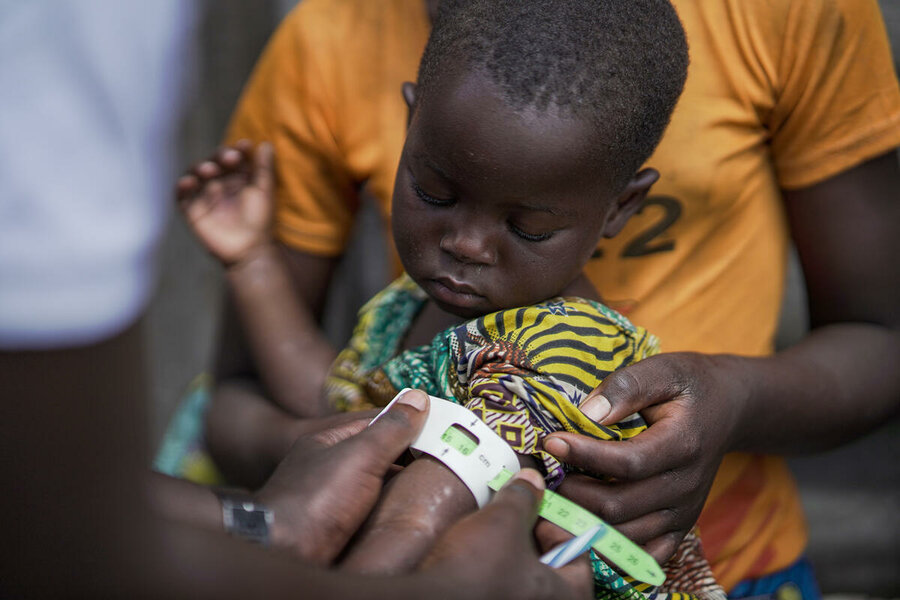A child is checked for malnutrition at Kanyaruchinya health centre, in DRC's conflict-hit Nord Kivu province. People Francis is expected to address conflict and hunger during his visit to the country. Photo: WFP/Michael Castofas