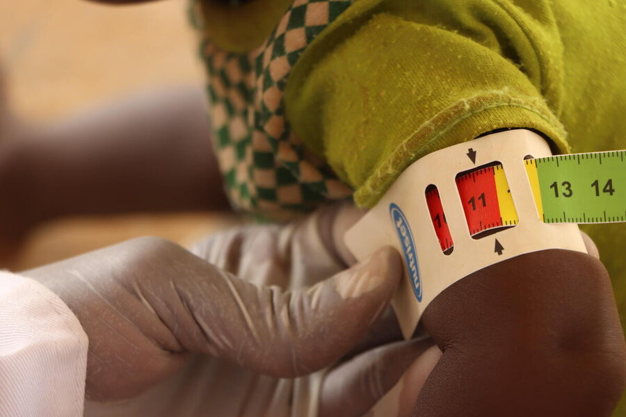 Acute malnutrition is soaring among children in Mali, exceeding WHO's emergency threshold. Photo: WFP/Aboubacar Sidibe