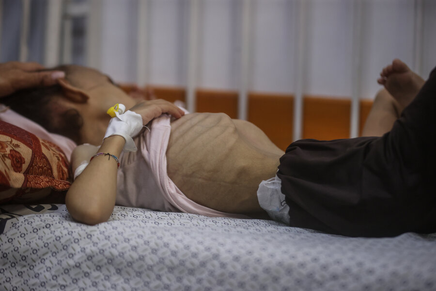 An emaciated little girl lies in a bed with a tube in her right wrist. Photo: WFP/Ali Jadallah