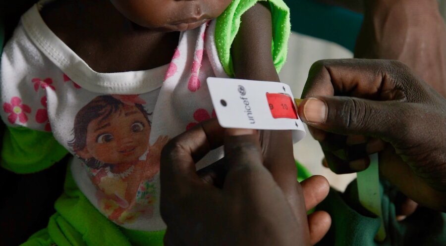 A closeup of a tape measuring malnutrition on the upper arm of a child, and showing red - the sign of severe-acute malnutrition. Photo: WFP/Gabriela Vivacqua