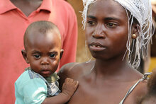Cameroon: Alarming levels of malnutrition among refugee children and women from C.A.R.