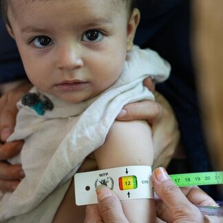 A person measuring the mid-upper arm circumference of a child using a tape.