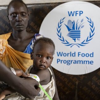 Child being screened for malnutrition in Bentiu.