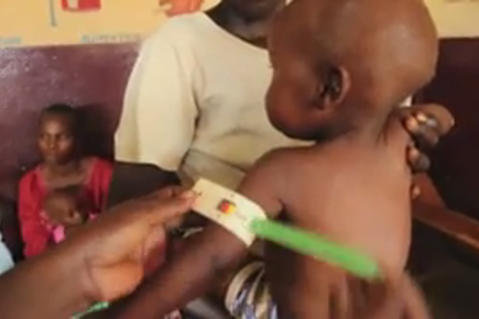 Malnutrition’s “Perfect Storm” in Central African Republic