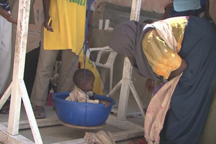 Mogadishu, Somalia. Wet Feeding Centers (For The Media)